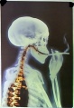 Skelett-raucht.jpg