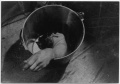 Amputation hand bucket MASH 1950.jpg